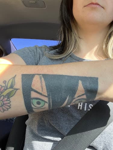 Zapn'Ink Laser Tattoo Removal